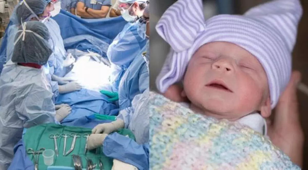 Premieră medicală în SUA. Un bebeluș s-a născut în urma unui transplant de uter prelevat de la o donatoare decedată