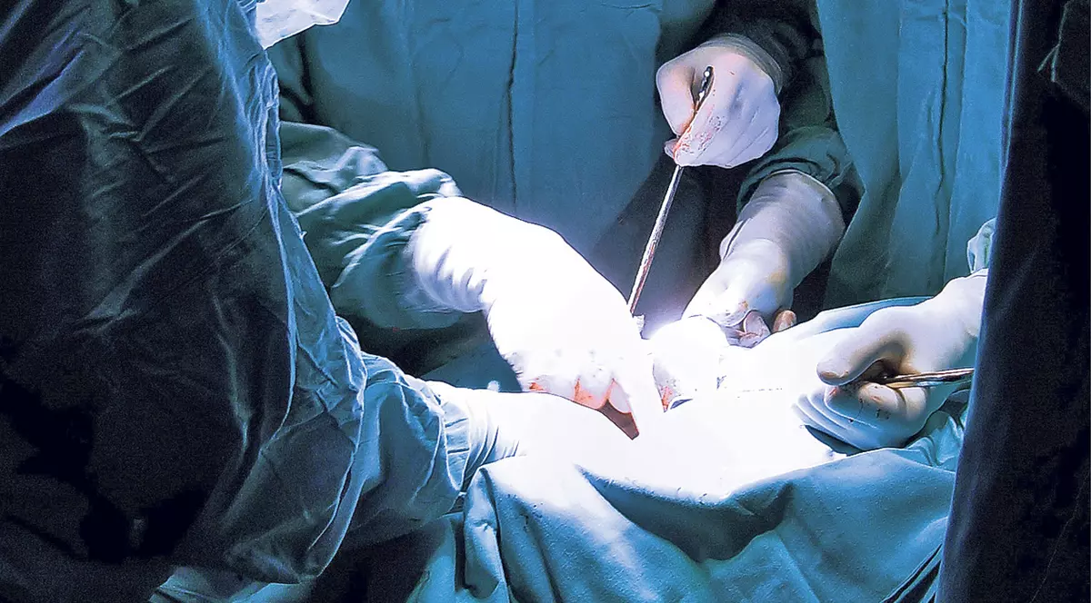 I-au amputat piciorul sănătos unei femei în vârstă de 66 de ani