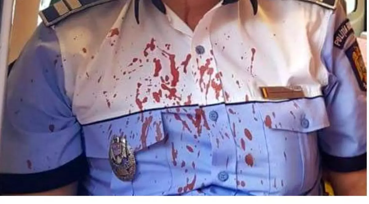 Un polițist vasluian a ajuns la spital după ce s-a dus să pună în aplicare un ordin de protecție!