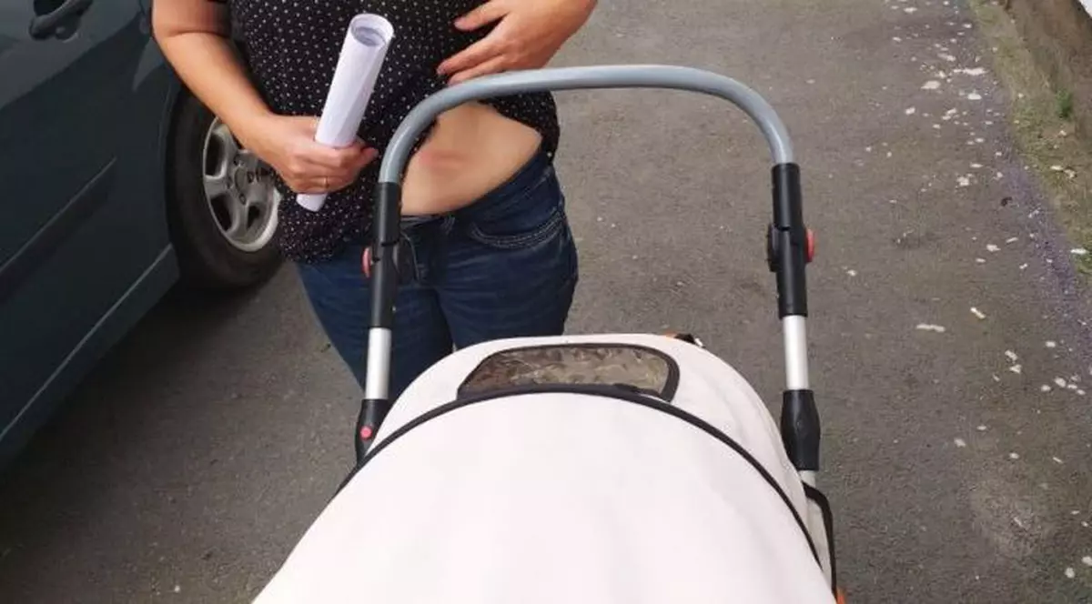 O mamă din Sibiu a fost bătută cu bâta de baseball de altă femeie. Copiii victimei și ai agresoarei au asistat la scenă