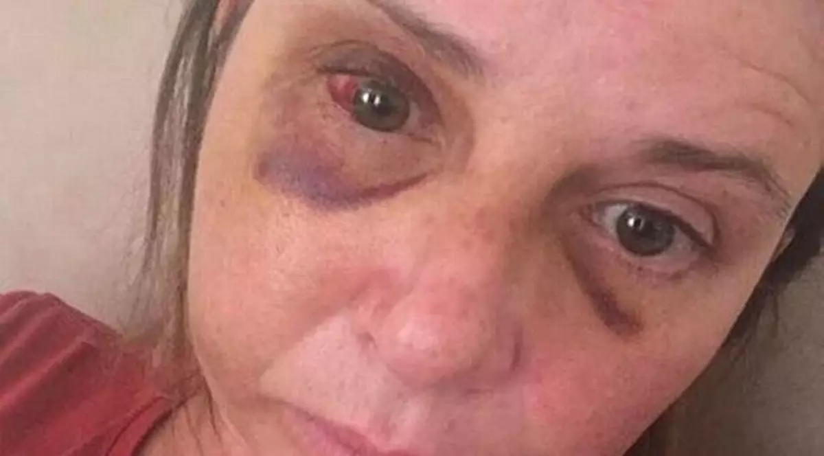 Cuvintele sfâșietoare spuse de un copil de trei ani după ce și-a văzut mama bătută crunt de tatăl lui (foto Jemma Palmer)