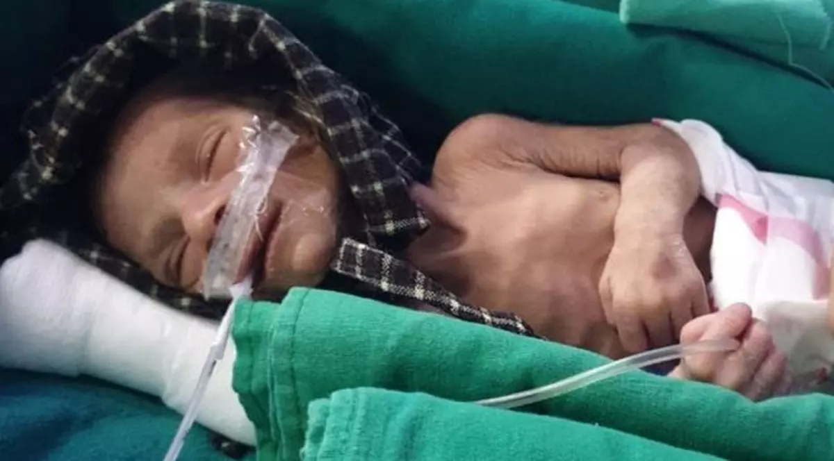 Fetiță nou-născută, găsită vie într-un mormânt improvizat în India