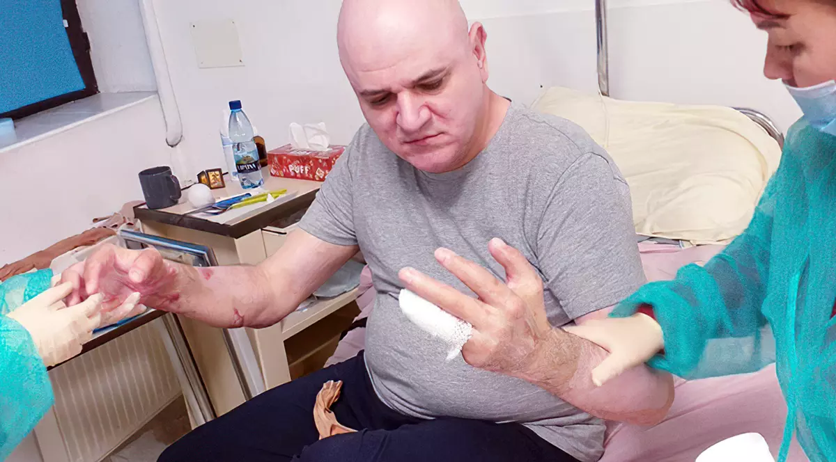 Pompierul Mihai Sfetcu a devenit primul mare ars din România căruia statul îi va plăti integral tratamentul de recuperare medicală  în străinătate