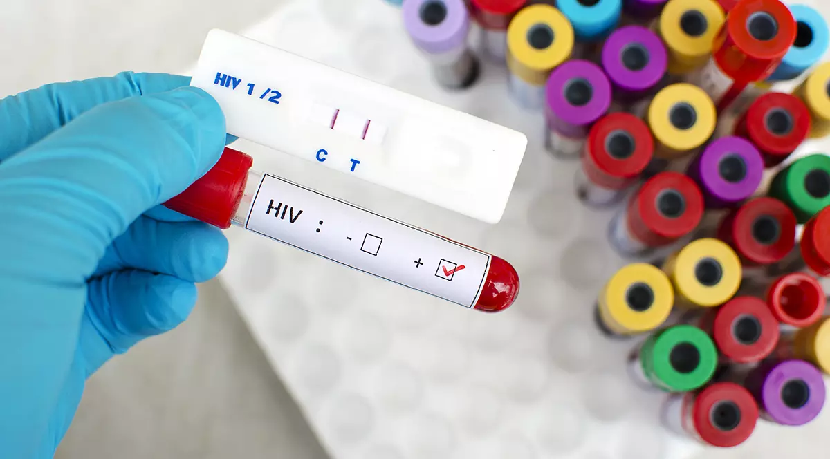 Un vaccin anti-HIV în care s-au pus mari speranţe, abandonat după testele clinice