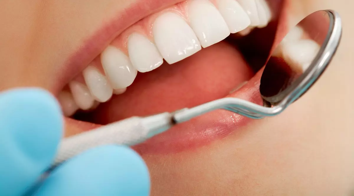 (Publicitate) De ce ai nevoie de igiena orala profesionala la un cabinet stomatologic?
