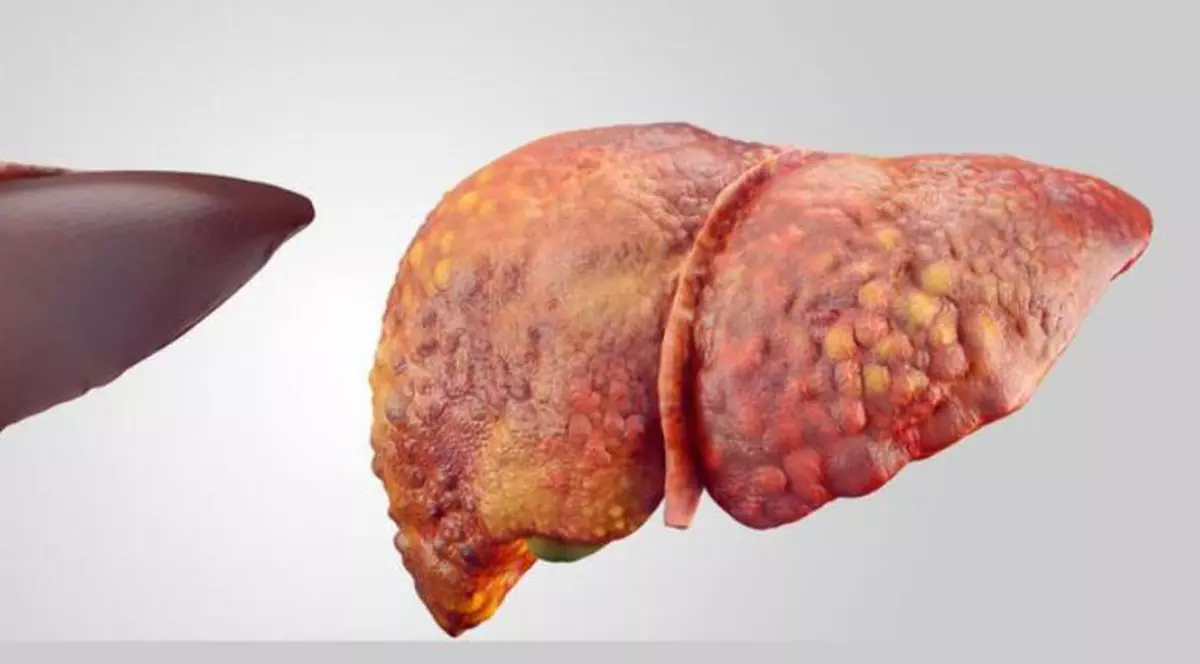 (Publicitate) Detoxifiați, regenerați și întăriți ficatul dumneavoastră după sărbători