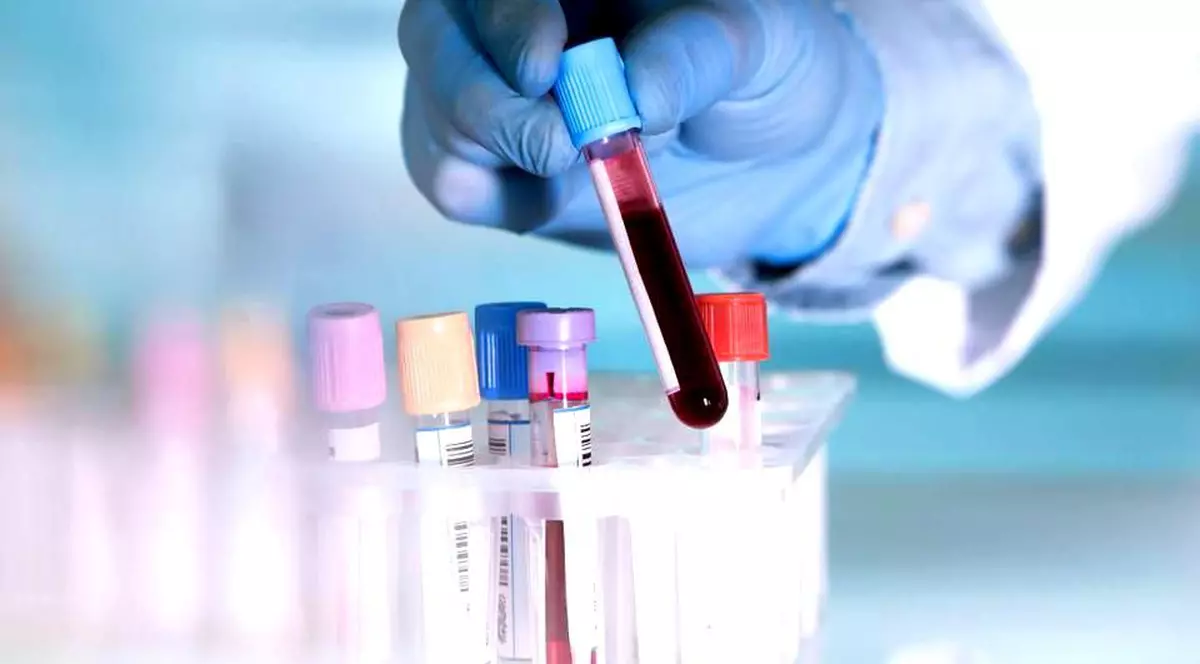 Peste 50 de tipuri de cancer pot fi detectate printr-un simplu test de sânge