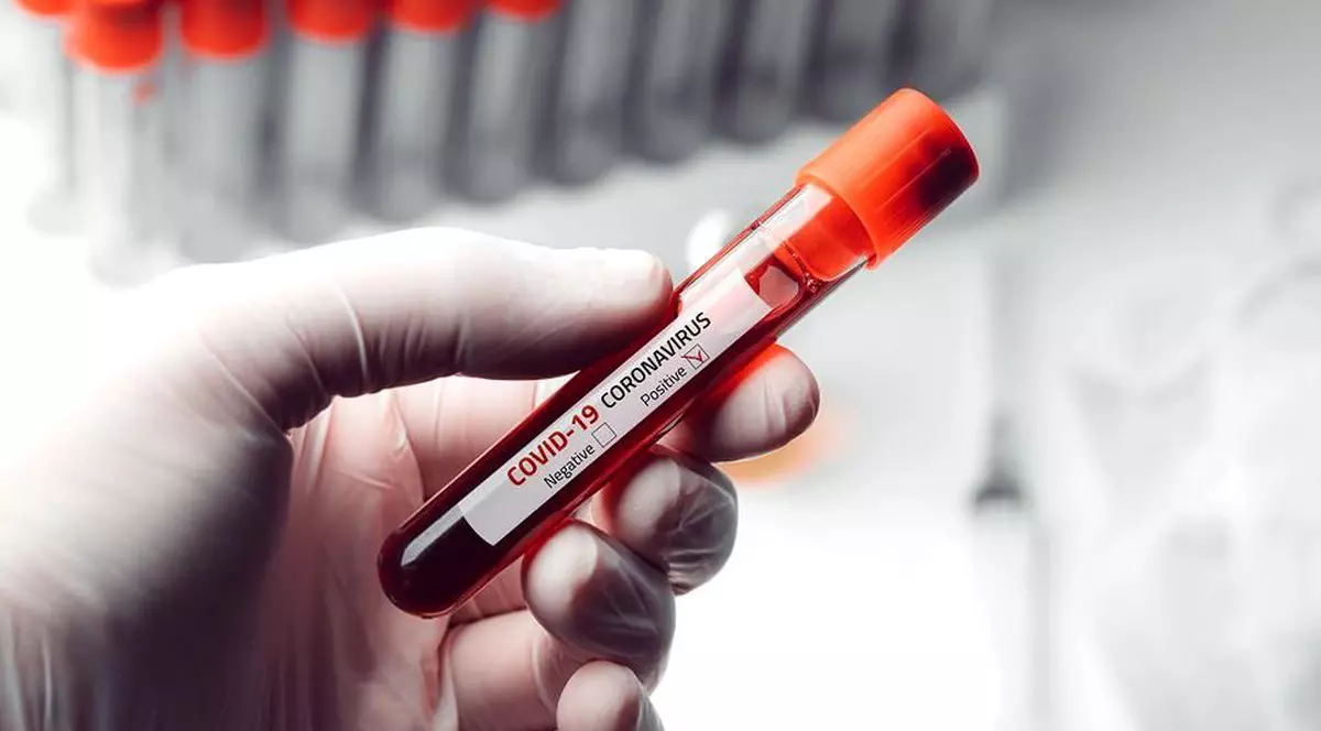 Câte teste a făcut România pentru depistarea coronavirusului. Ministerul Sănătății dă asigurări că stocurile sunt suficiente