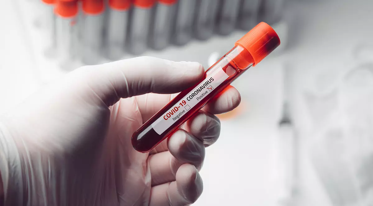 Ministerul Sănătății demontează un fake news care circulă online în privinţa neutralizării coronavirusului