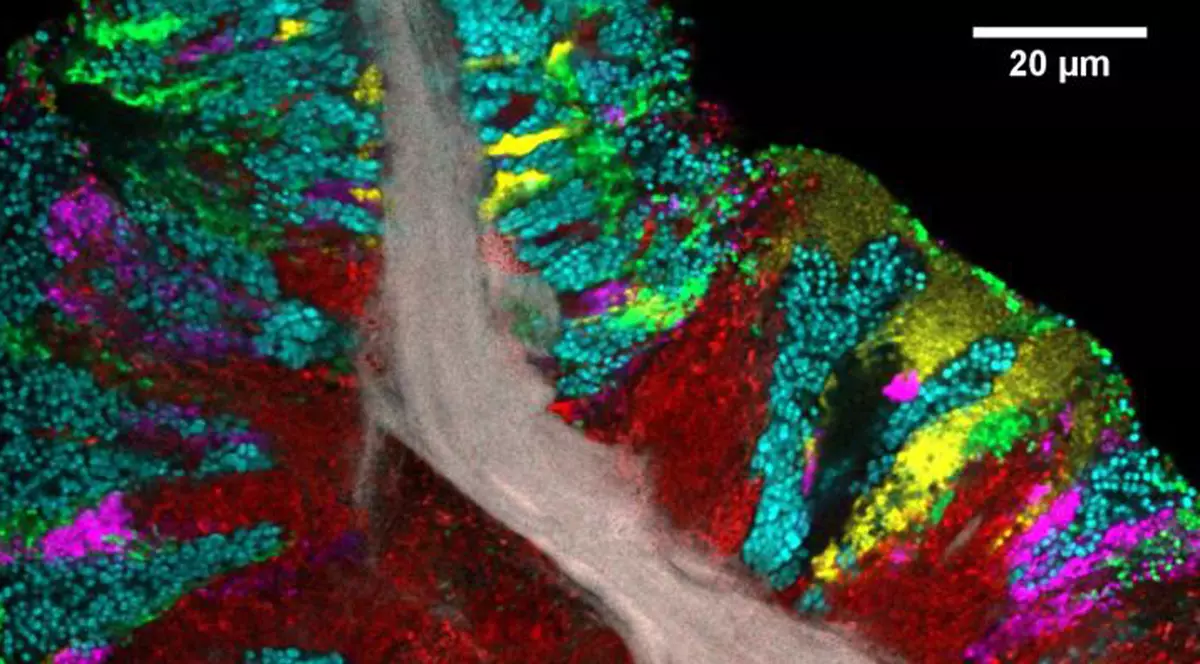 Culorile corespund diferitelor colonii de microbi prezente pe limba umană. FOTO: HEPTA
