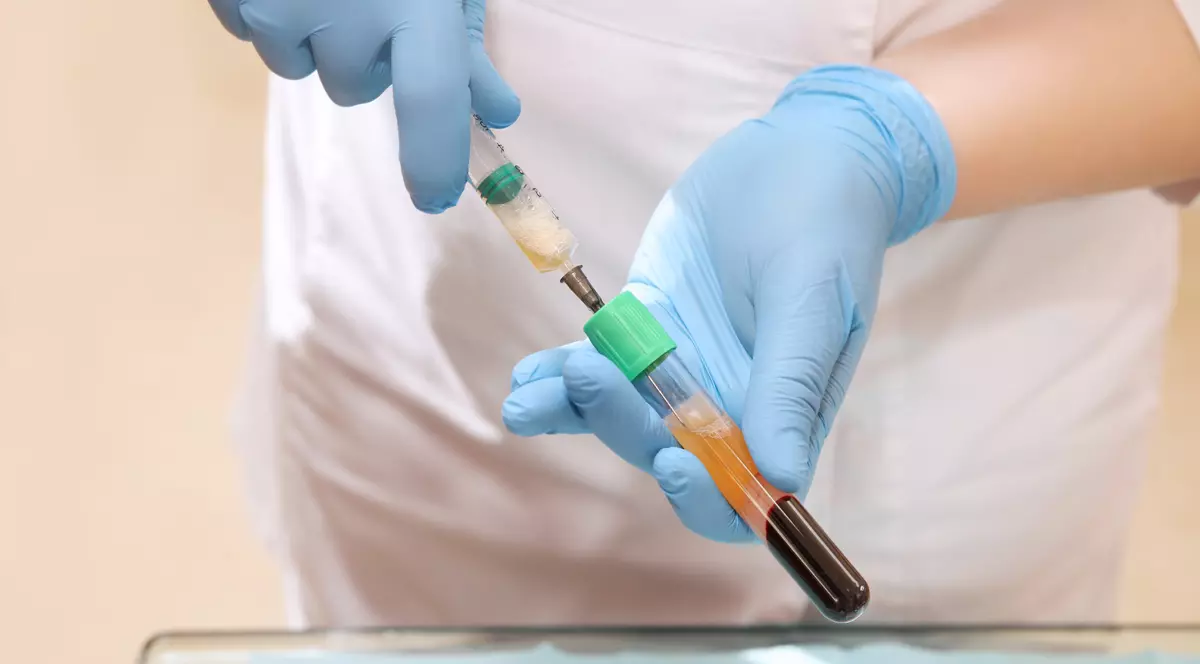 Tratamentul cu plasmă reduce cu 57% rata de mortalitate a pacienților cu coronavirus, potrivit unui nou studiu