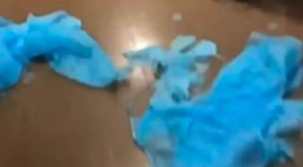 Filmuleț incredibil. Cum se dezintegrează costumele de protecție ale unor asistente medicale din Franța VIDEO
