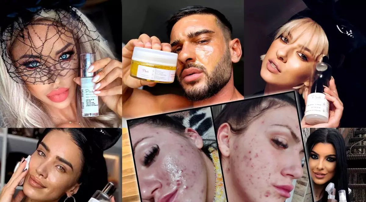 Deși zeci de tinere au acuzat că le-au distrus tenul, influenceri și vedete nu se dezic de produsele Plush Bio. Dorian Popa e cel mai vehement apărător, dar nu a folosit cremele cu probleme