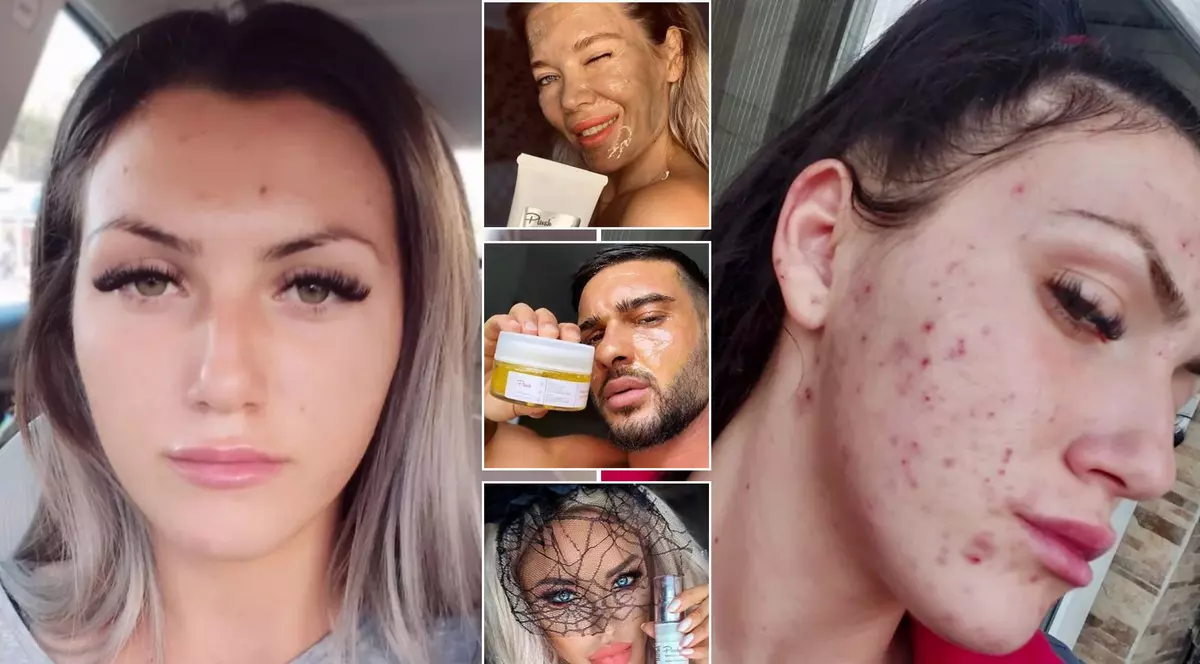„Fața mea a început să se descompună”. Un fals dermatolog e acuzat că a vândut produse toxice pentru ten, promovate de vedete precum Dorian Popa și Gina Pistol. Mai multe victime au făcut plângere