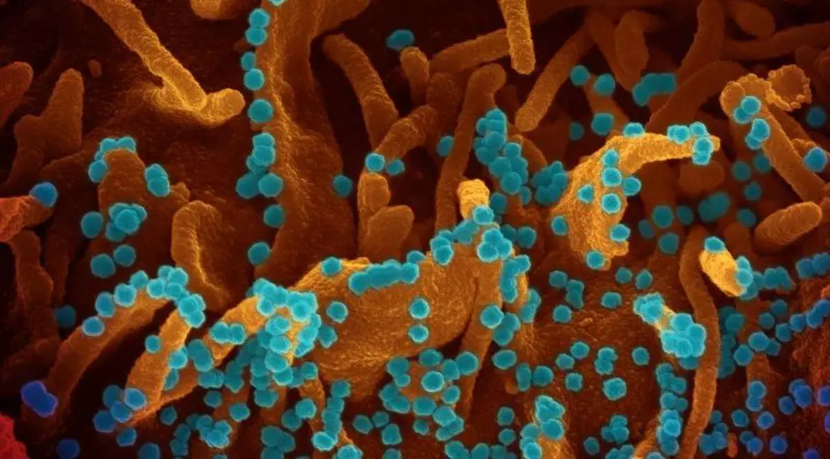 Cum au fost realizate cele mai impresionante imagini cu COVID-19. “Încercăm să-l facem vizibil, ca să vadă oamenii cu cine luptăm”