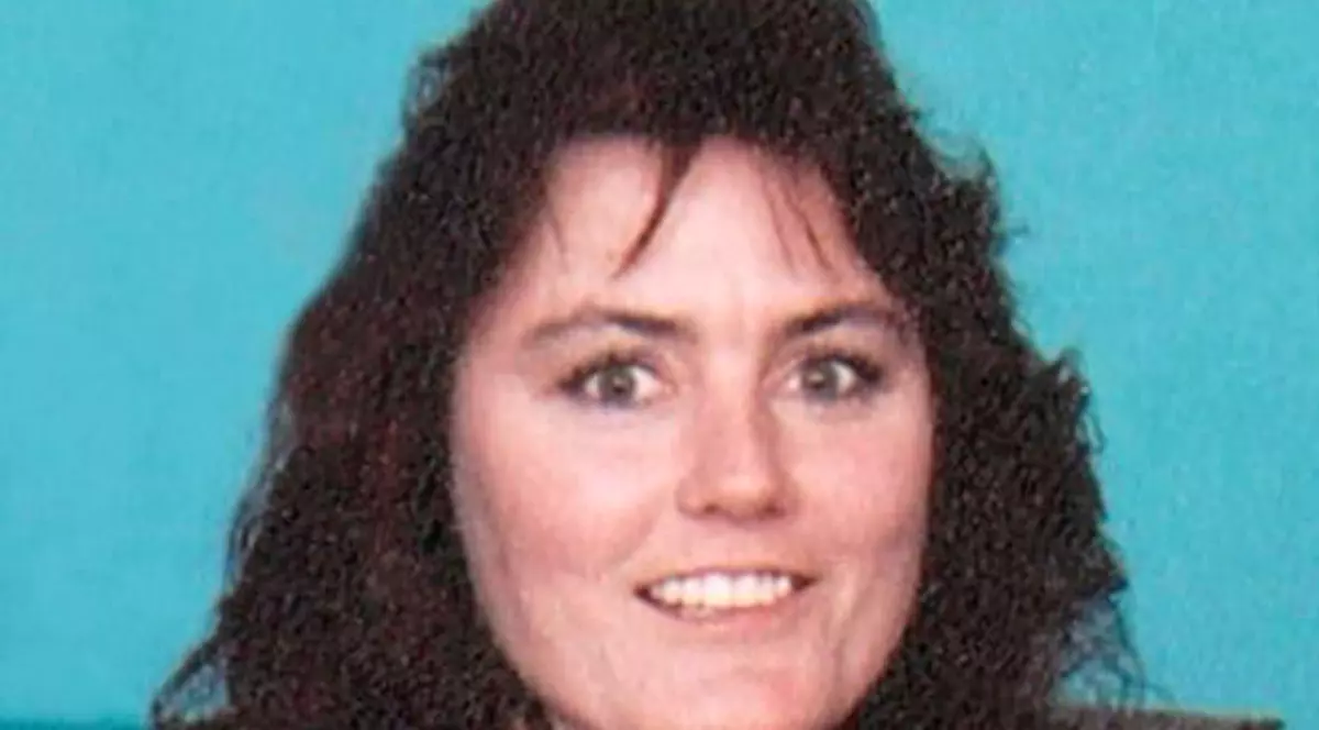 Prima persoană din SUA cu transplant de față a murit. Femeii îi lipsea nasul, osul palatal şi ochiul drept