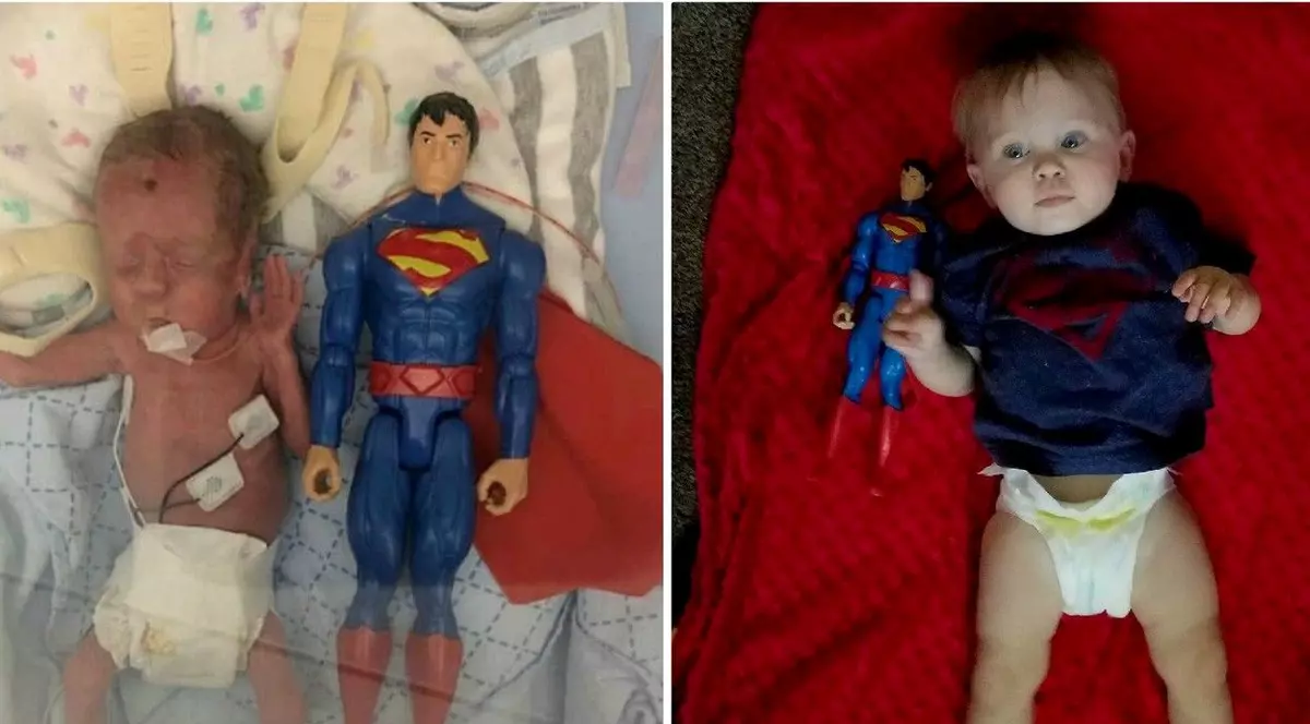 Povestea băieţelului care la naştere era cât o figurină Superman. Medicii nu i-au dat șanse de supraviețuire