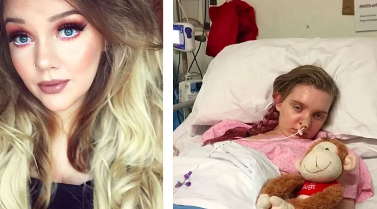 Cum a ajuns o tânără britanică manechin de succes, după ce a fost închisă într-un spital de psihiatrie și i s-au aplicat electroșocuri