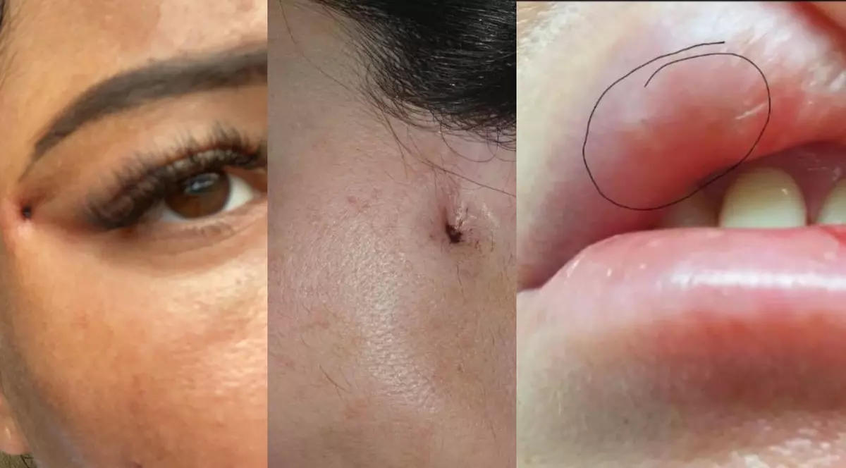 Mărturiile clientelor desfigurate de „Dr.Lana”, cosmeticiana care pretindea că e medic estetician. „M-a făcut praf”