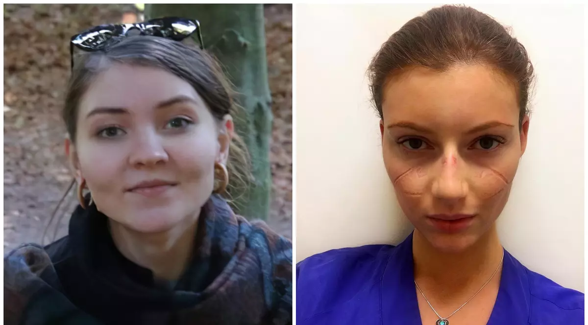 „Modelul suedez” de combatere a pandemiei, trăit de două studente în cel mai mare focar COVID din țară: „Nu există nicio obligație, doar recomandări”