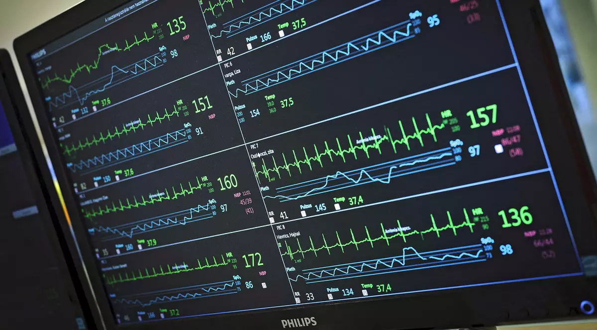 Un elev din Republica Moldova a ajuns la terapie intensivă, după ce a fost pedepsit de profesoara de sport cu 150 de genuflexiuni