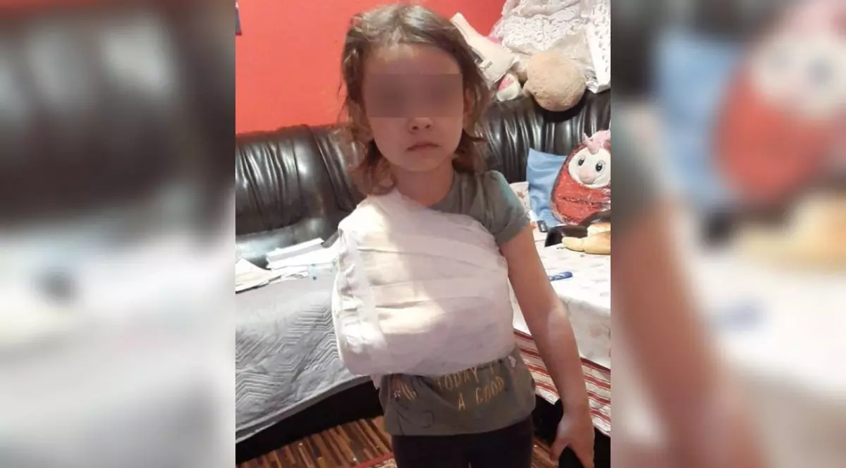 Un medic de la spitalul din Corabia e acuzat că a bandajat mâna unei fetițe cu tot cu tricou. Managerul spune că procedura a fost corectă, DSP a dat amendă