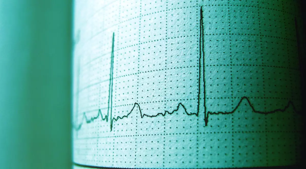 (Publicitate) Cele mai frecvente boli cardiovasculare și metodele de diagnostic