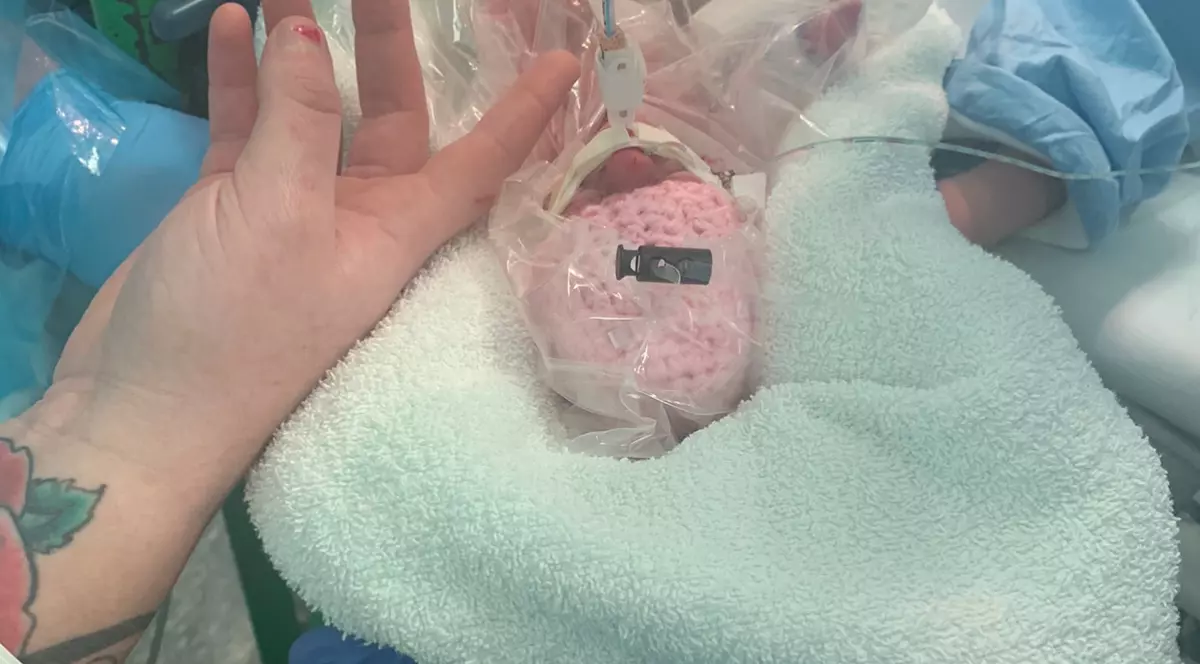 Un bebeluș născut prematur în Marea Britanie, salvat de medici cu ajutorul unei pungi de sandvici