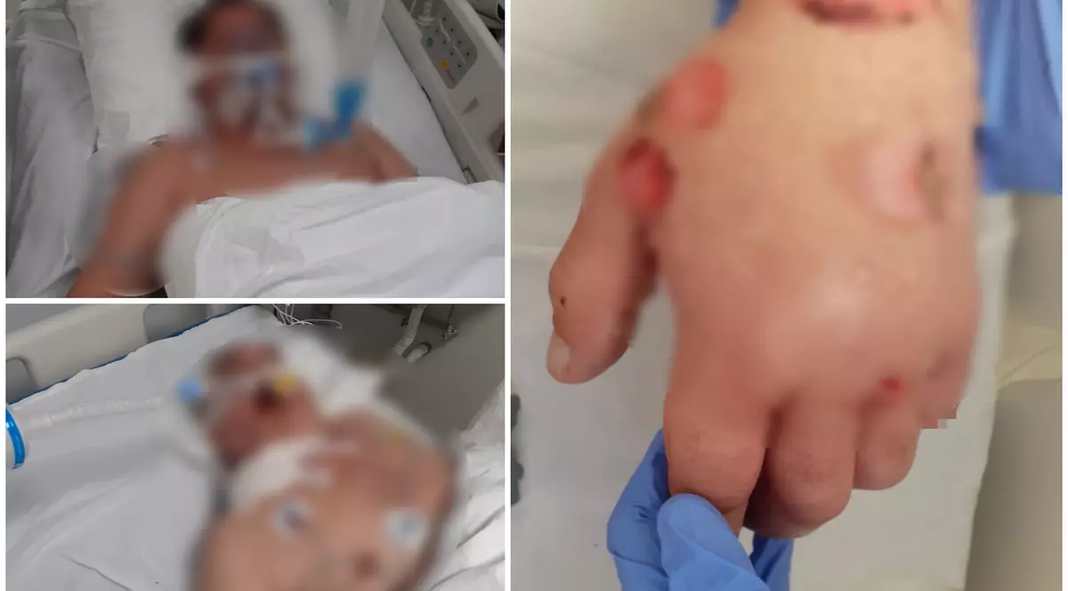 Spitalul Județean Sibiu respinge acuzațiile asistentului care a spus că pacienții de la ATI mor cu zile, legați și sedați. „Un pacient agitat poate să se autolezeze”