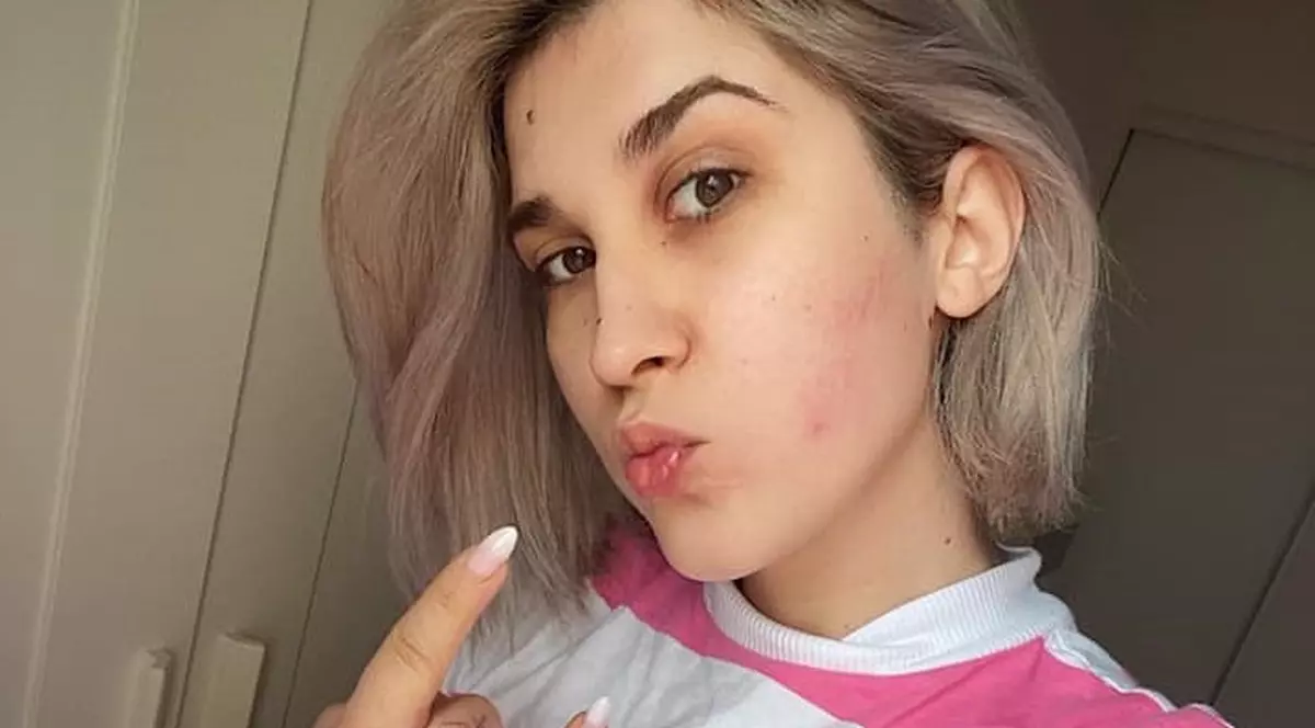 Adda caută rezolvare la medicii din străinătate pentru problema ei de sănătate. „Nu mă las”