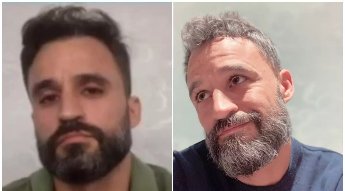 Asistent medical spaniol, în două poze făcute la un an distanță. Cât de mult l-a afectat pandemia