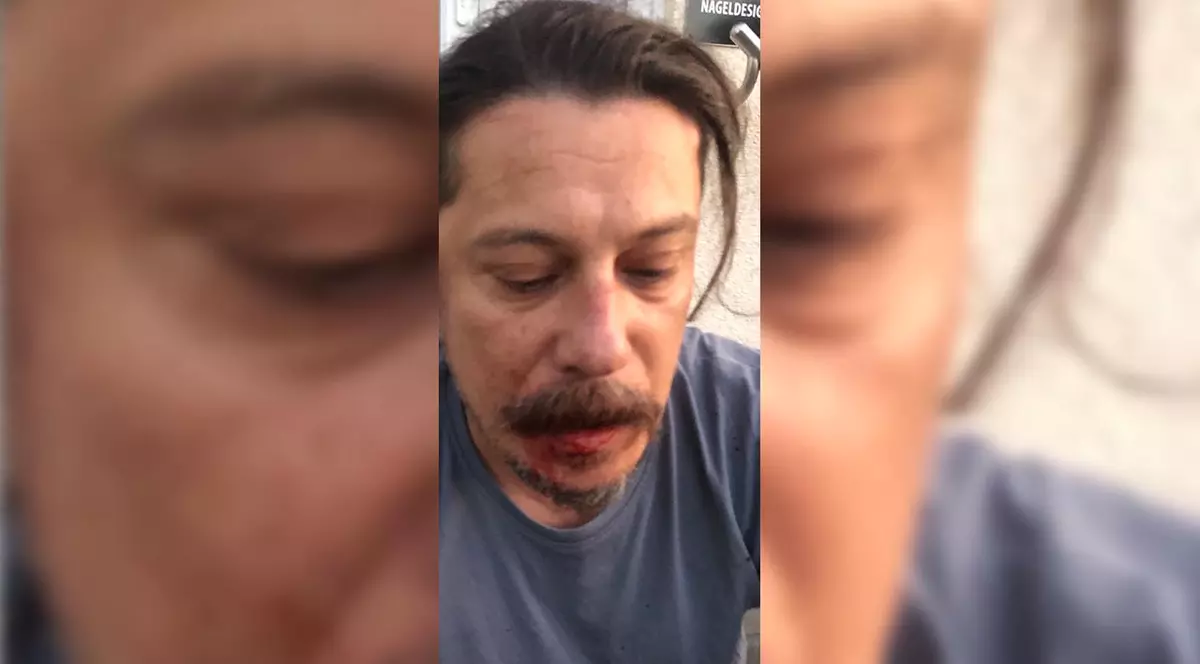 Jurnalistul turc Erk Acarer, critic al regimului Erdogan, atacat cu cuțitul în propria casă, în Berlin. Cum se simte