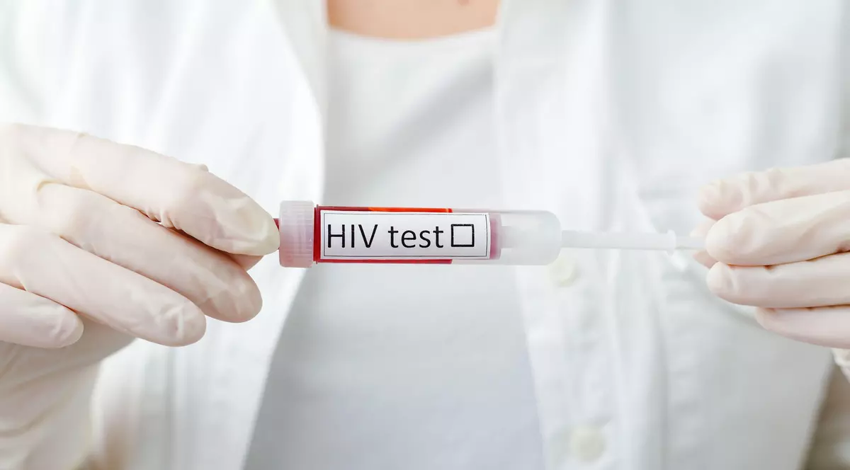 ﻿Pandemia COVID a agravat situaţia HIV în România. Rata de testare s-a prăbușit, numărul infectărilor a crescut