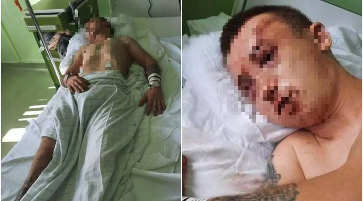 Tânăr bătut, tâlhărit și lăsat inconștient pe un trotuar, în Arad. Agresorii, cercetați în stare de libertate