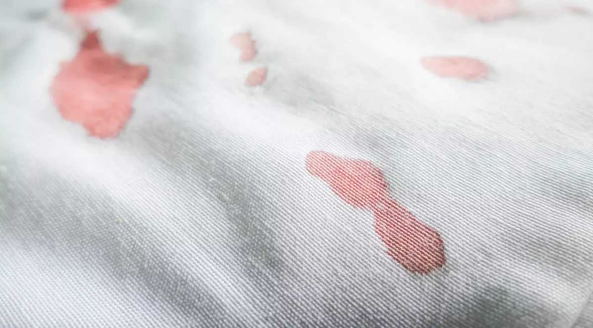 Cum să cureți petele de vopsea de pe haine. Trucuri ieftine și rapide