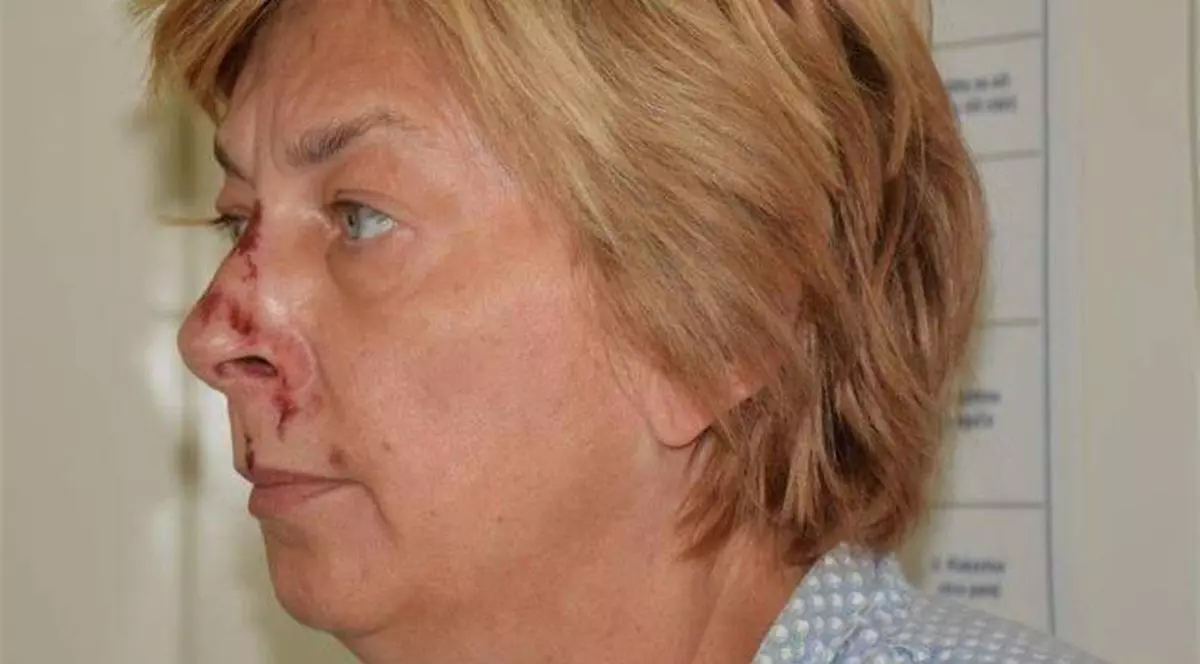 O femeie găsită într-o zonă pustie din Croația nu își amintește cum a ajuns acolo. Ce au descoperit acum autoritățile
