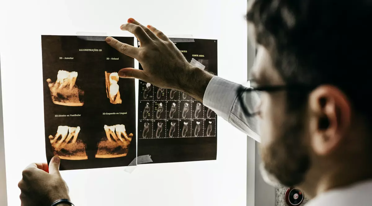 Top 5 lucruri pe care dentistul tău ar vrea ca tu să le știi