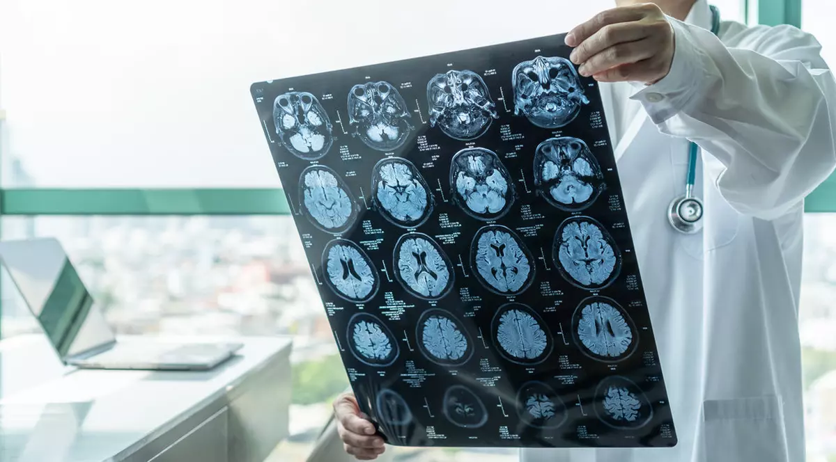 Mai mulți tineri dintr-o provincie canadiană, afectați de o boală neurologică misterioasă. Medicii nu știu ce o declanșează