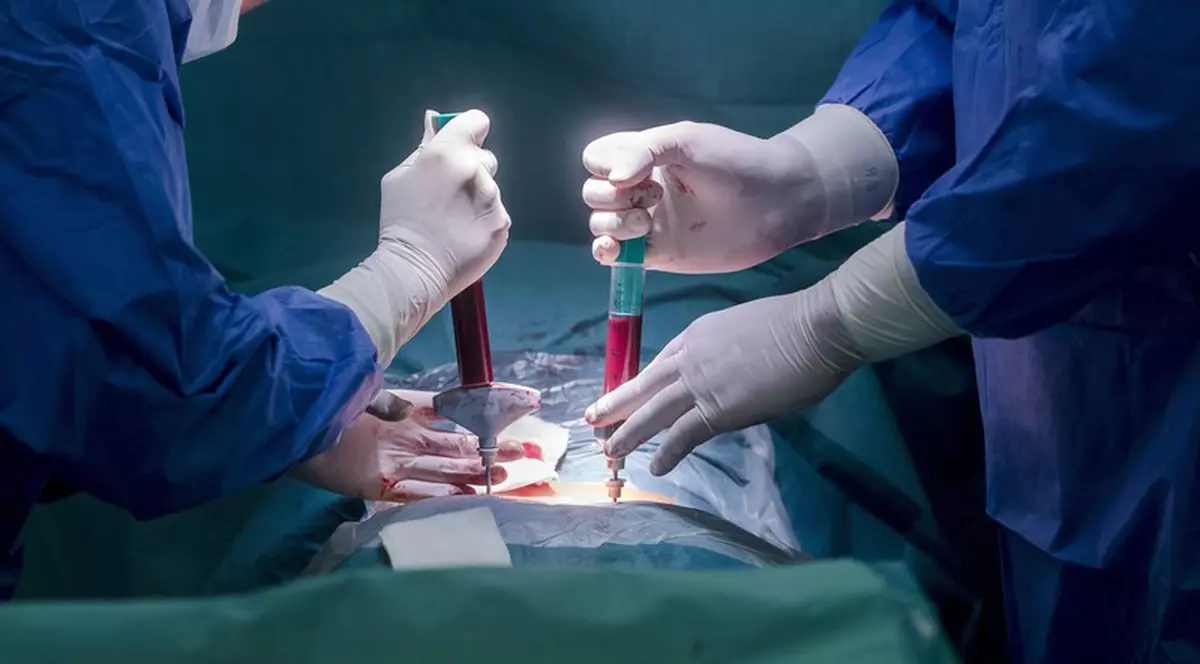 Un nou transplant de celule stem pare să fi vindecat de HIV o a treia persoană în lume