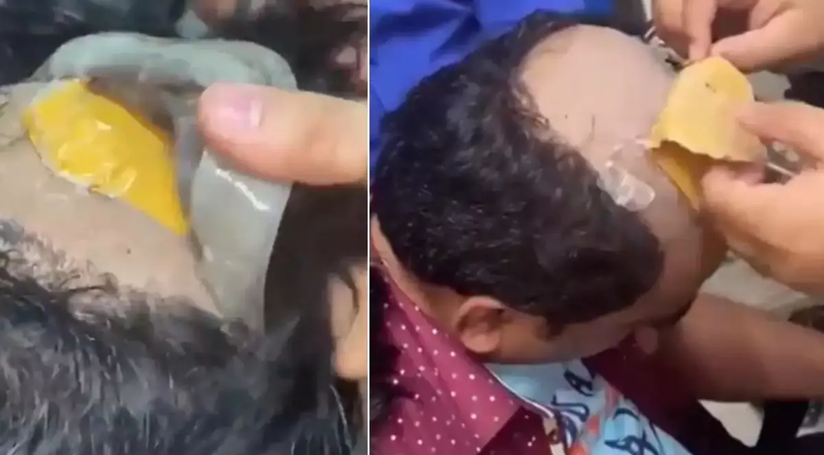 Aur de 40.000 de dolari lipit de cap, sub perucă, de un contrabandist indian chel