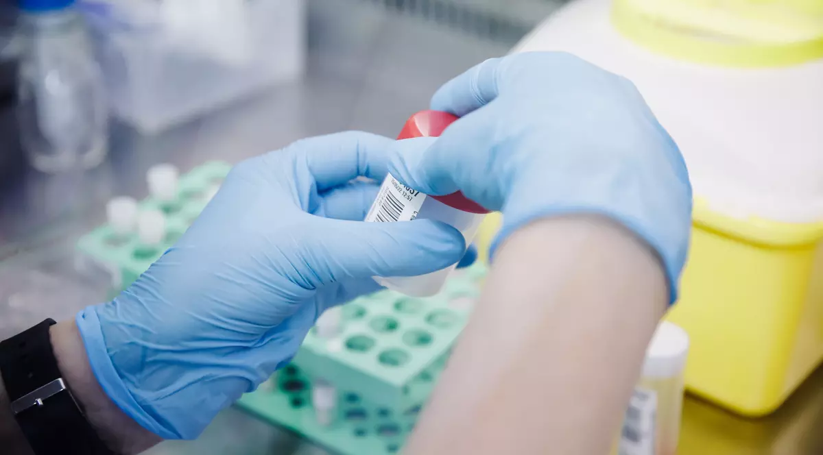 OMS decide astăzi dacă declară variola maimuței o „urgenţă de sănătate publică internaţională”