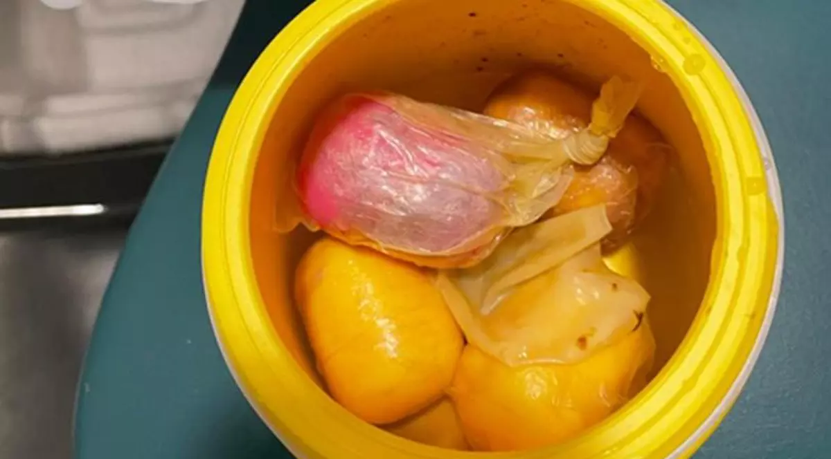 Un bărbat a încercat să intre cu cocaină ascunsă în ouă de ciocolată Kinder, în Australia