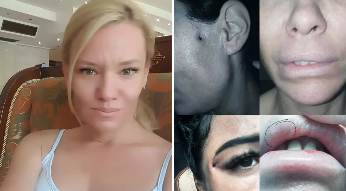 Pedeapsa primită de „Dr. Lana”, dentista din Republica Moldova judecată pentru că făcea operații estetice în România fără drept de practică