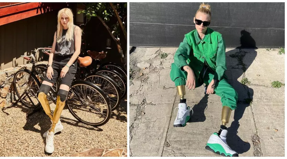 Povestea incredibilă a modelului care a rămas fără picioare din cauza unui tampon. A sfidat toate piedicile puse de soartă