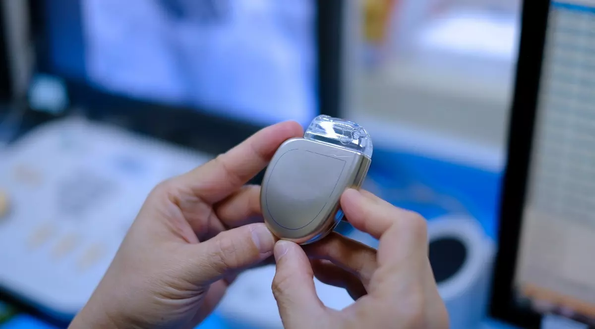 Noi precizări ale Ministerului Sănătății în dosarul stimulatoarelor cardiace: Legislația interzice reutilizarea acestor dispozitive