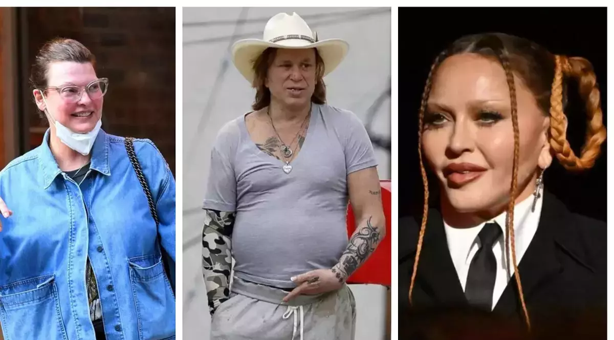 Top 6 vedete desfigurate de intervențiile estetice