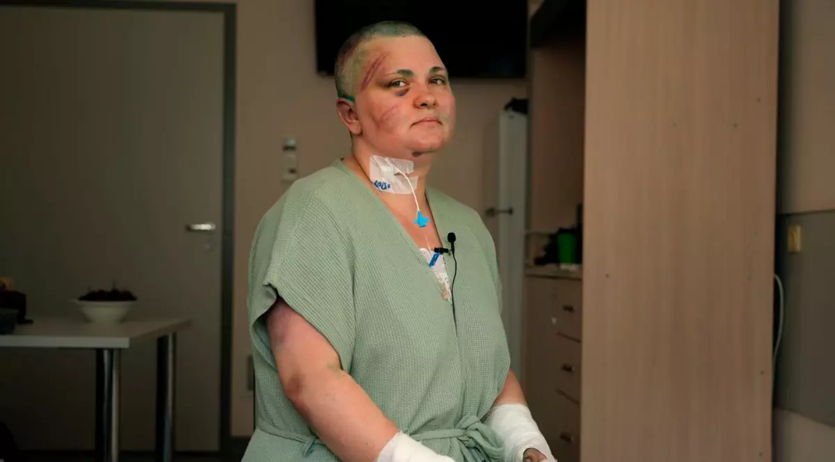 Jurnalista de la Novaia Gazeta bătută crunt promite că va continua să meargă în Cecenia, în ciuda amenințării lui Kadîrov că o „va distruge”
