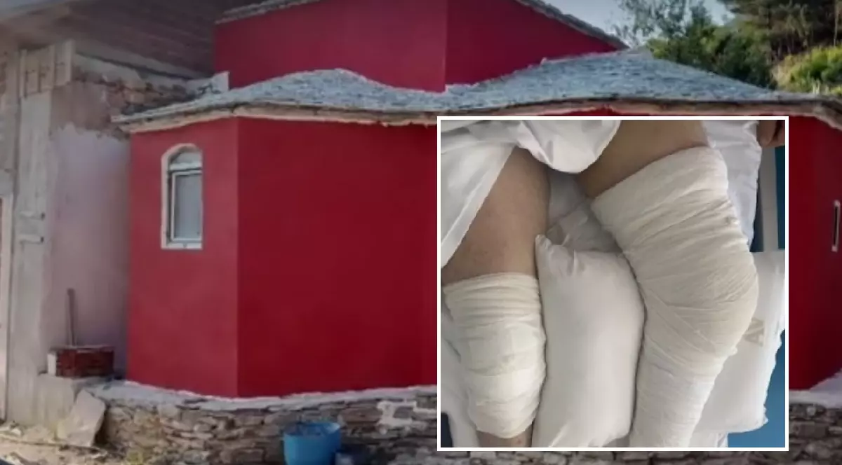 Un român a fost împușcat în ambele picioare de un preot, tot român, de la Muntele Athos: „S-a dus la centrală, a luat arma de vânătoare, am auzit poc!”