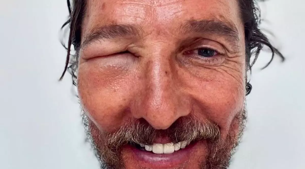 Matthew McConaughey