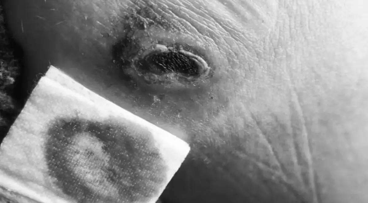 Ce a pățit o tânără din Elveția care a adormit pe încărcătorul de telefon băgat în priză: „Îmi voi face un tatuaj”. Imagini care vă pot afecta emoțional